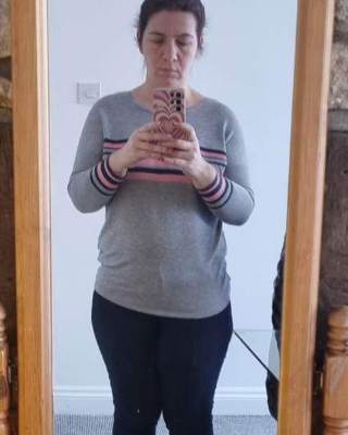 Daniela după gastric sleeve