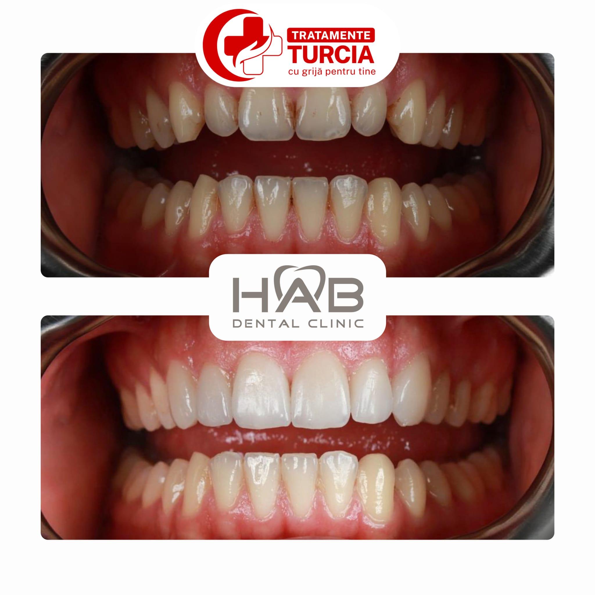 HAB Dental Clinic Vadistanbul — fotografia 27