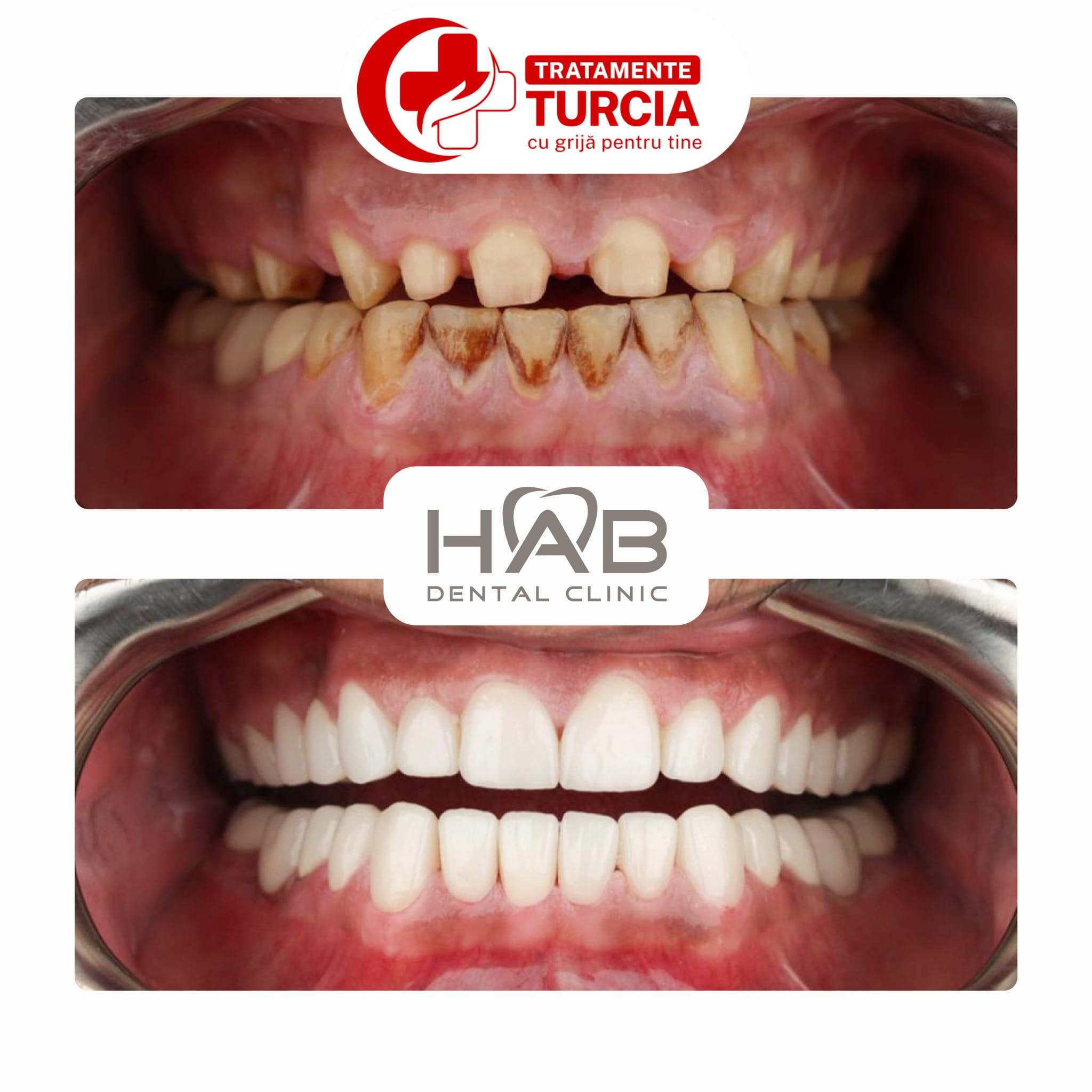 HAB Dental Clinic Vadistanbul — fotografia 20