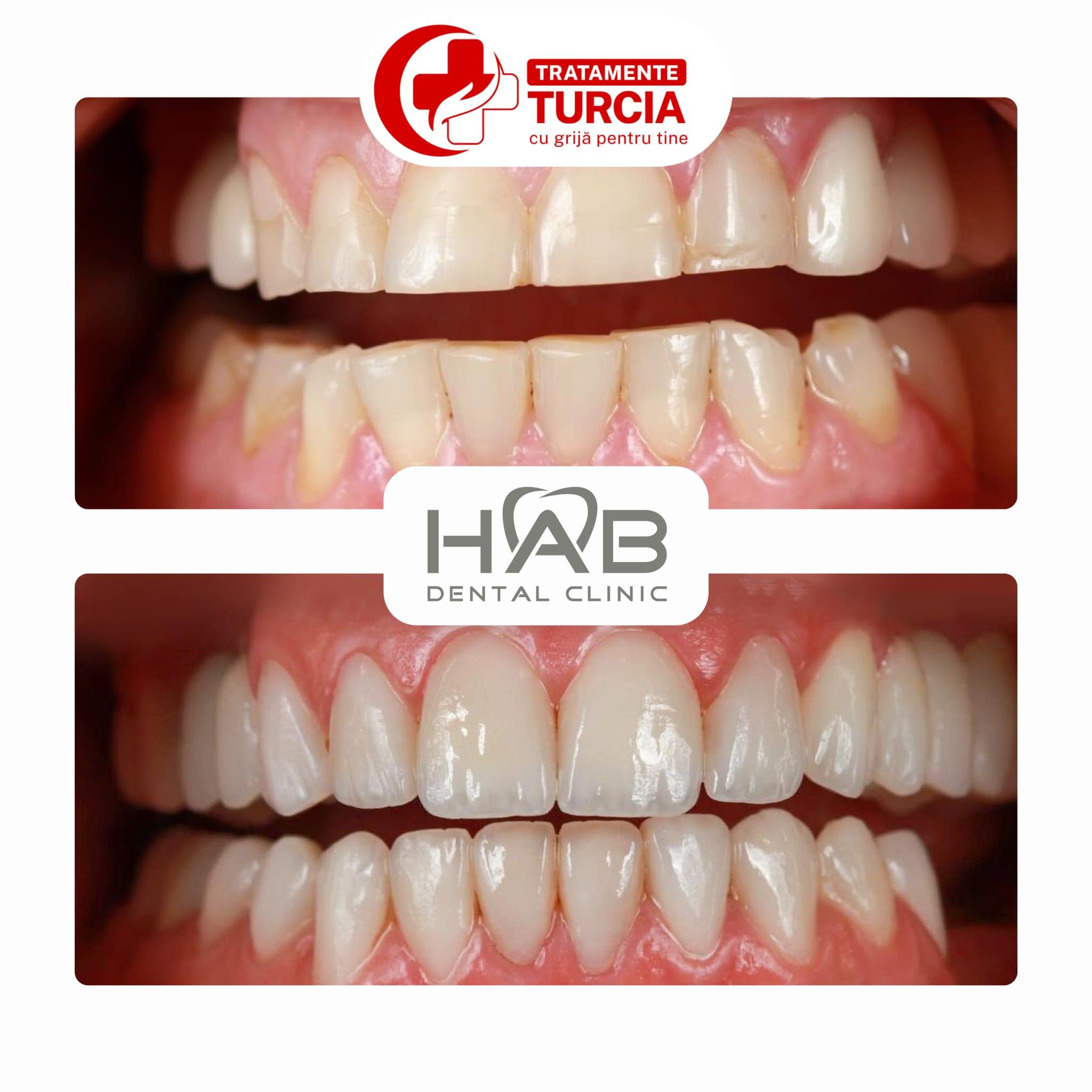 HAB Dental Clinic Vadistanbul — fotografia 29
