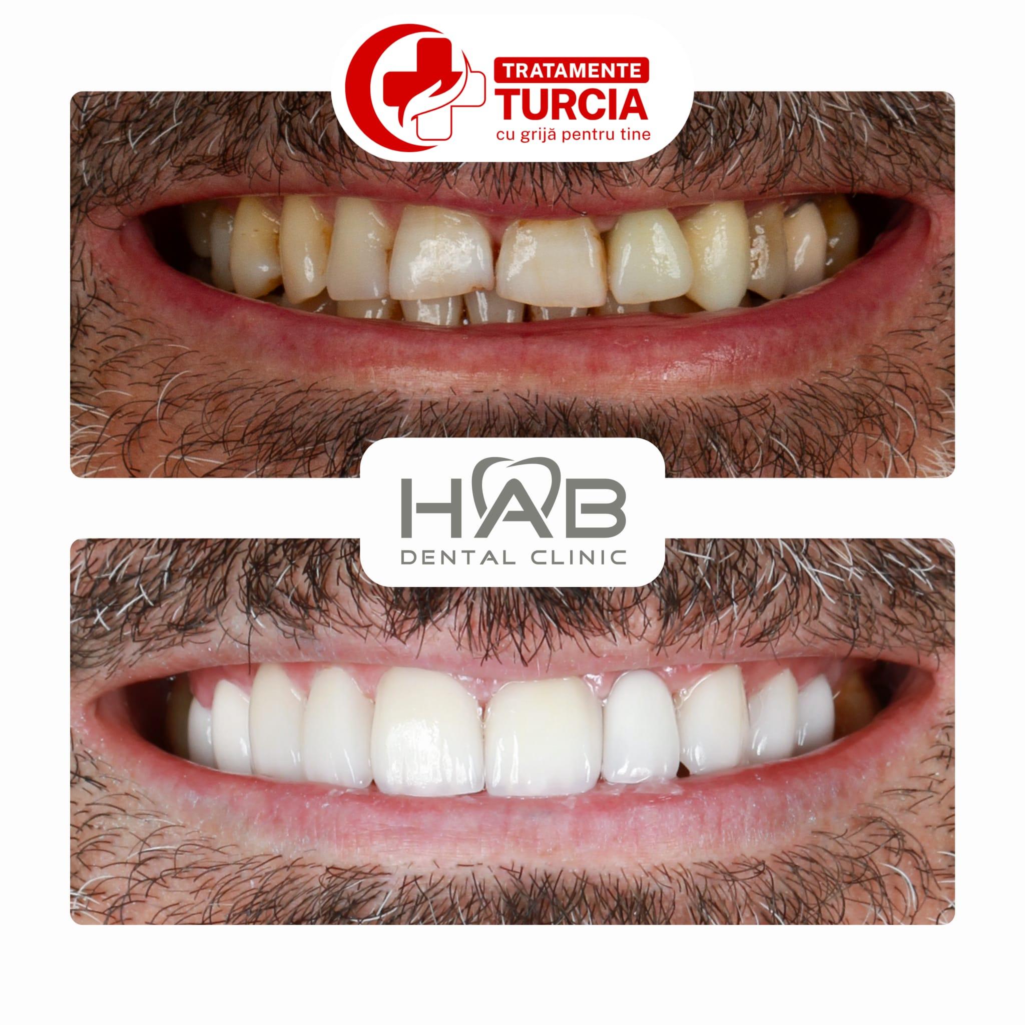 HAB Dental Clinic Vadistanbul — fotografia 17