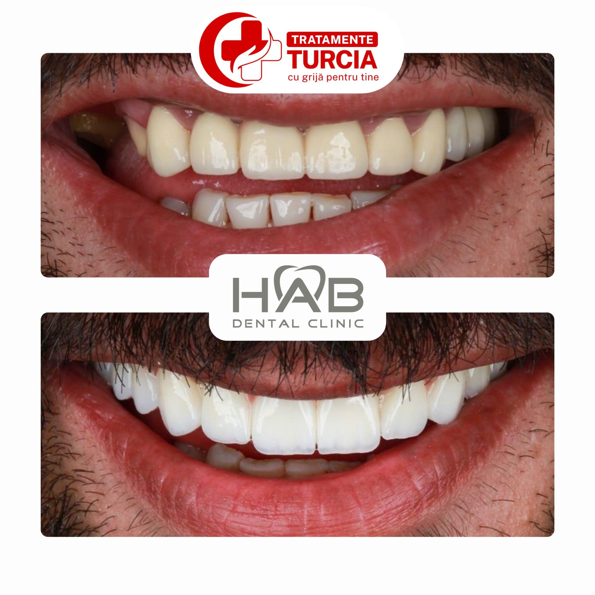 HAB Dental Clinic Vadistanbul — fotografia 26