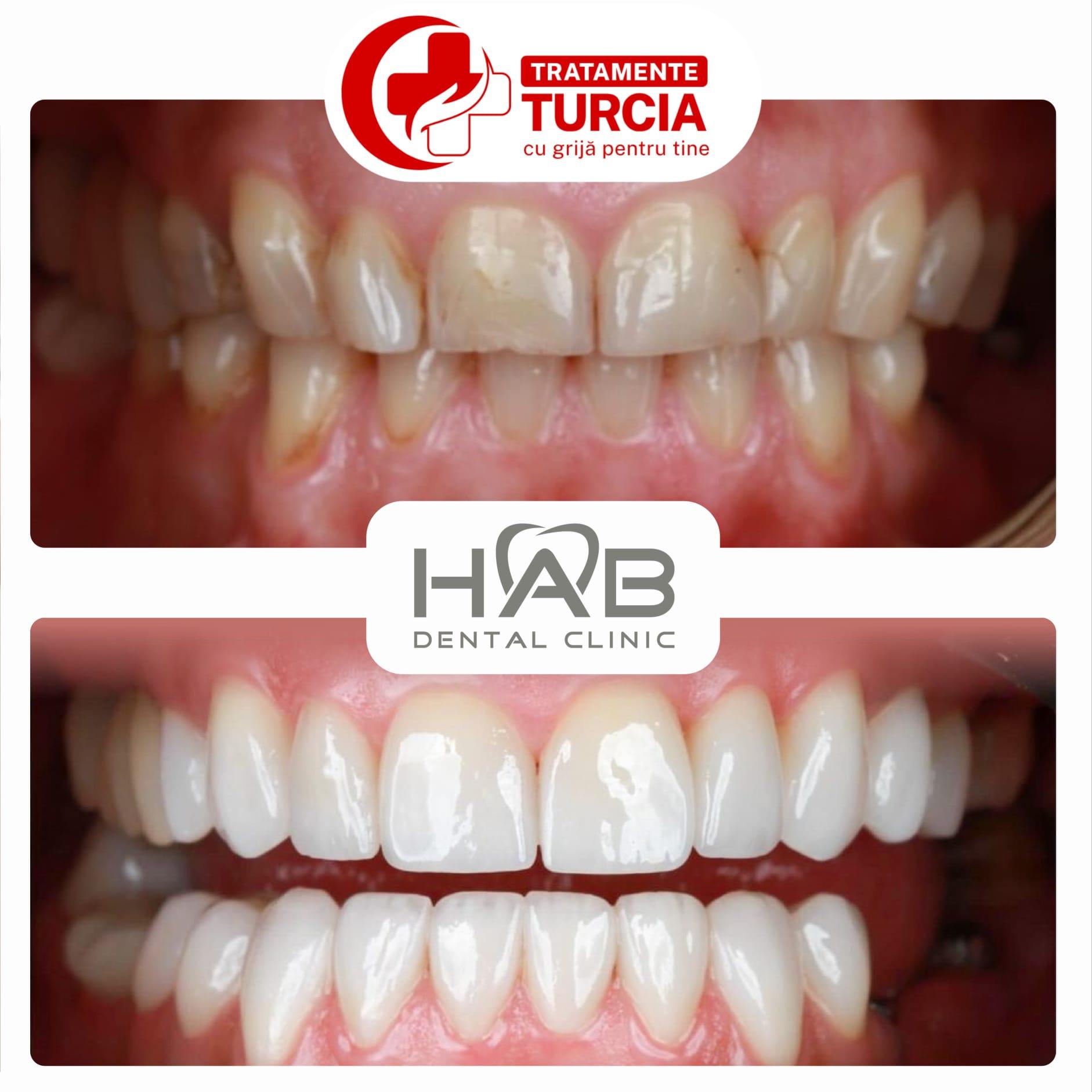 HAB Dental Clinic Vadistanbul — fotografia 18