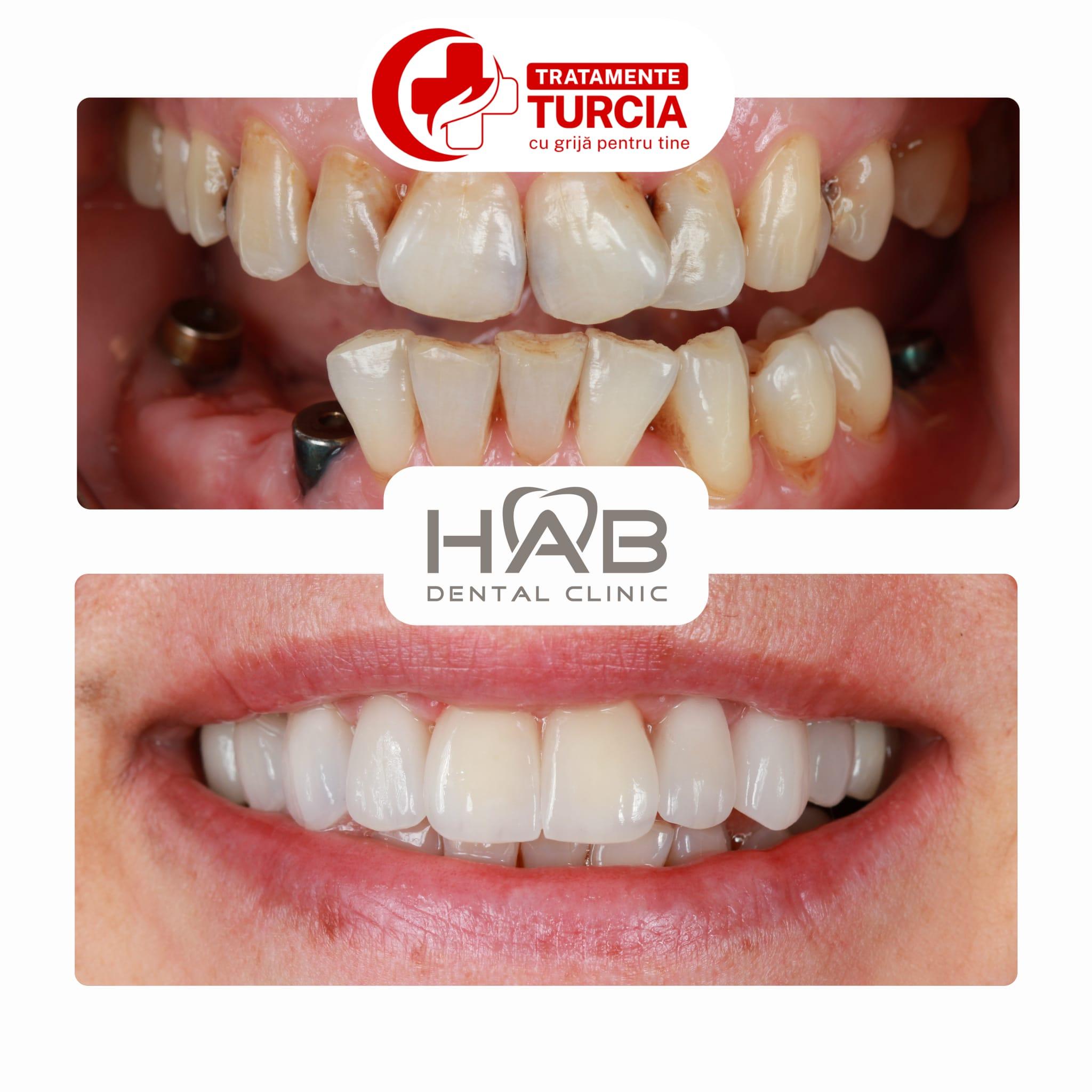 HAB Dental Clinic Vadistanbul — fotografia 19