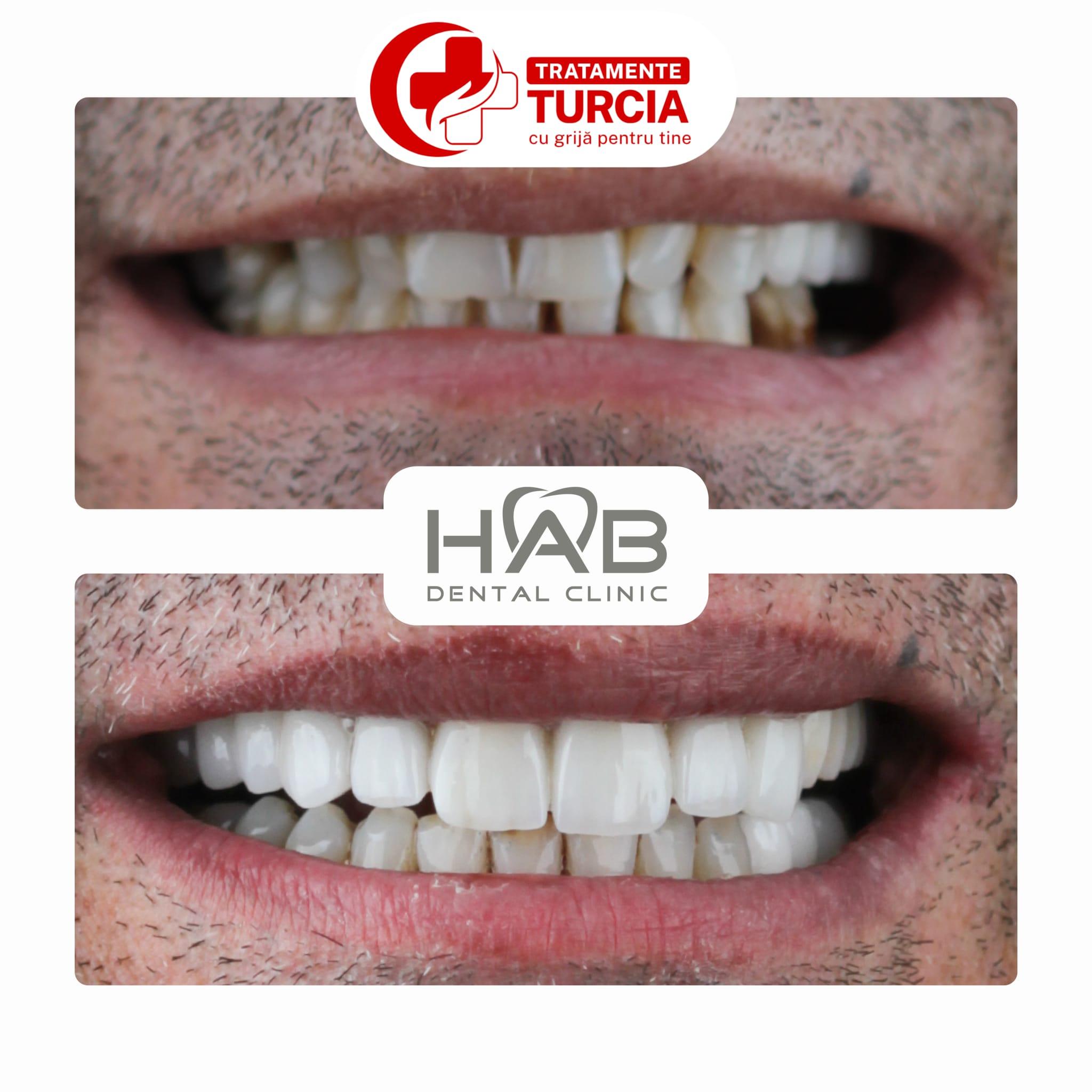 HAB Dental Clinic Vadistanbul — fotografia 23