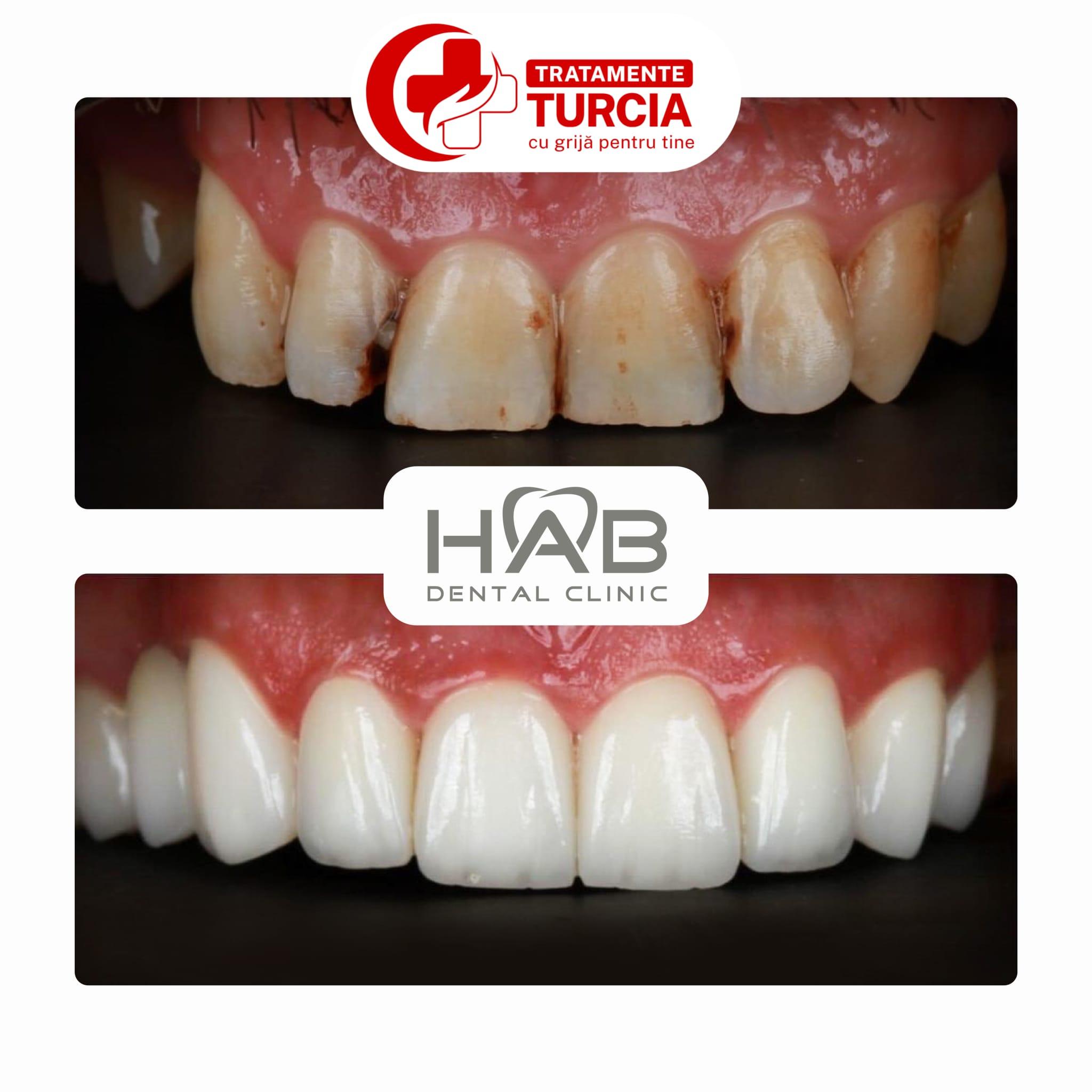 HAB Dental Clinic Vadistanbul — fotografia 24