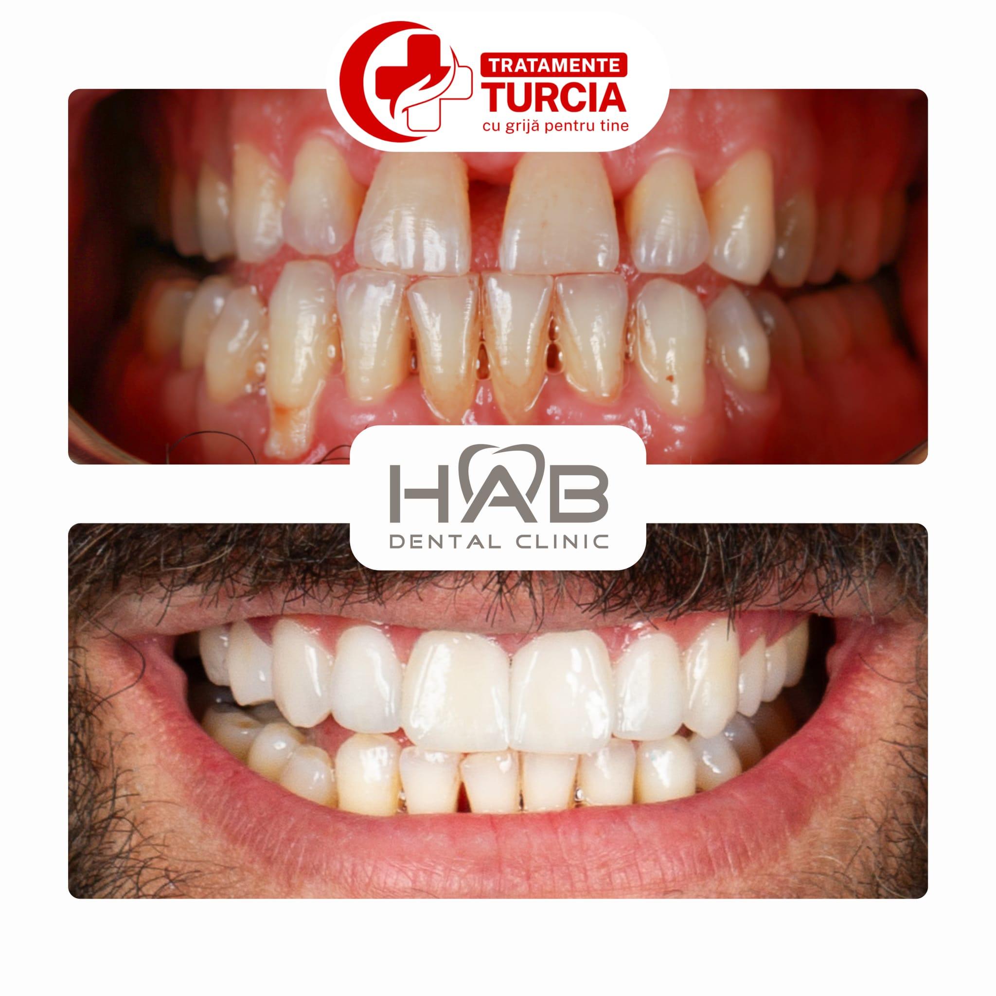 HAB Dental Clinic Vadistanbul — fotografia 28