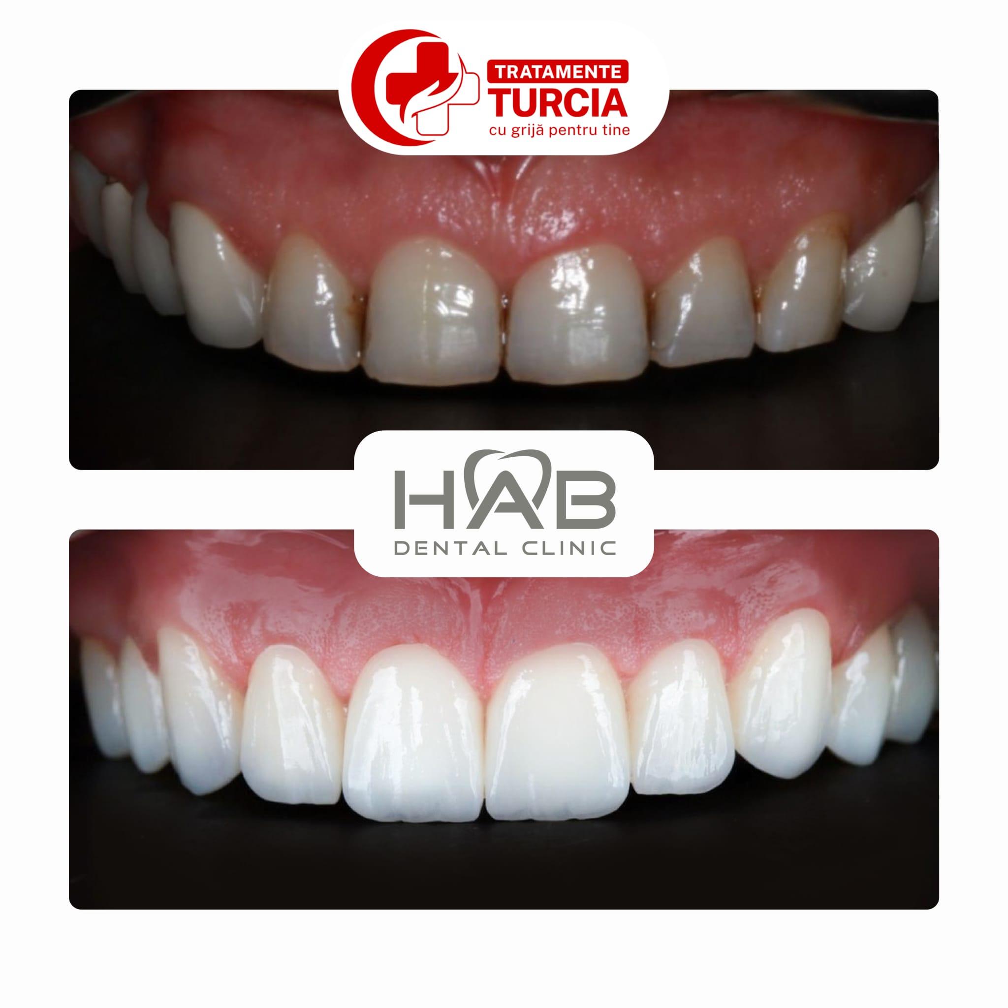 HAB Dental Clinic Vadistanbul — fotografia 21