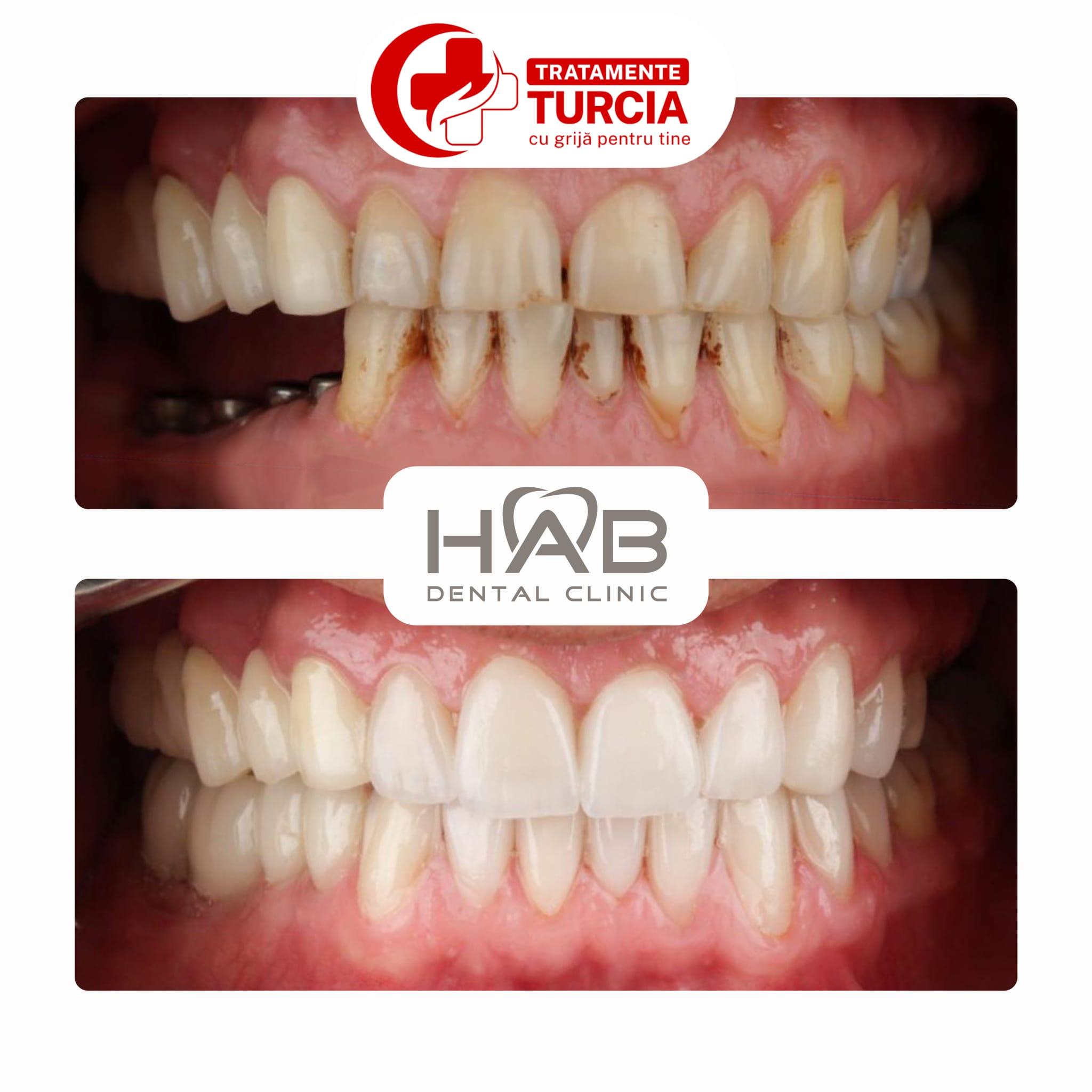 HAB Dental Clinic Vadistanbul — fotografia 25