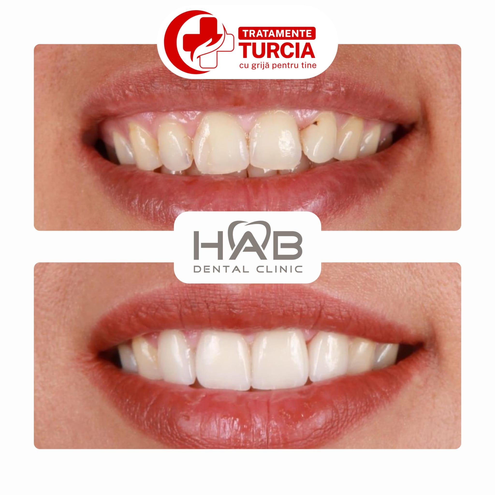 HAB Dental Clinic Vadistanbul — fotografia 30