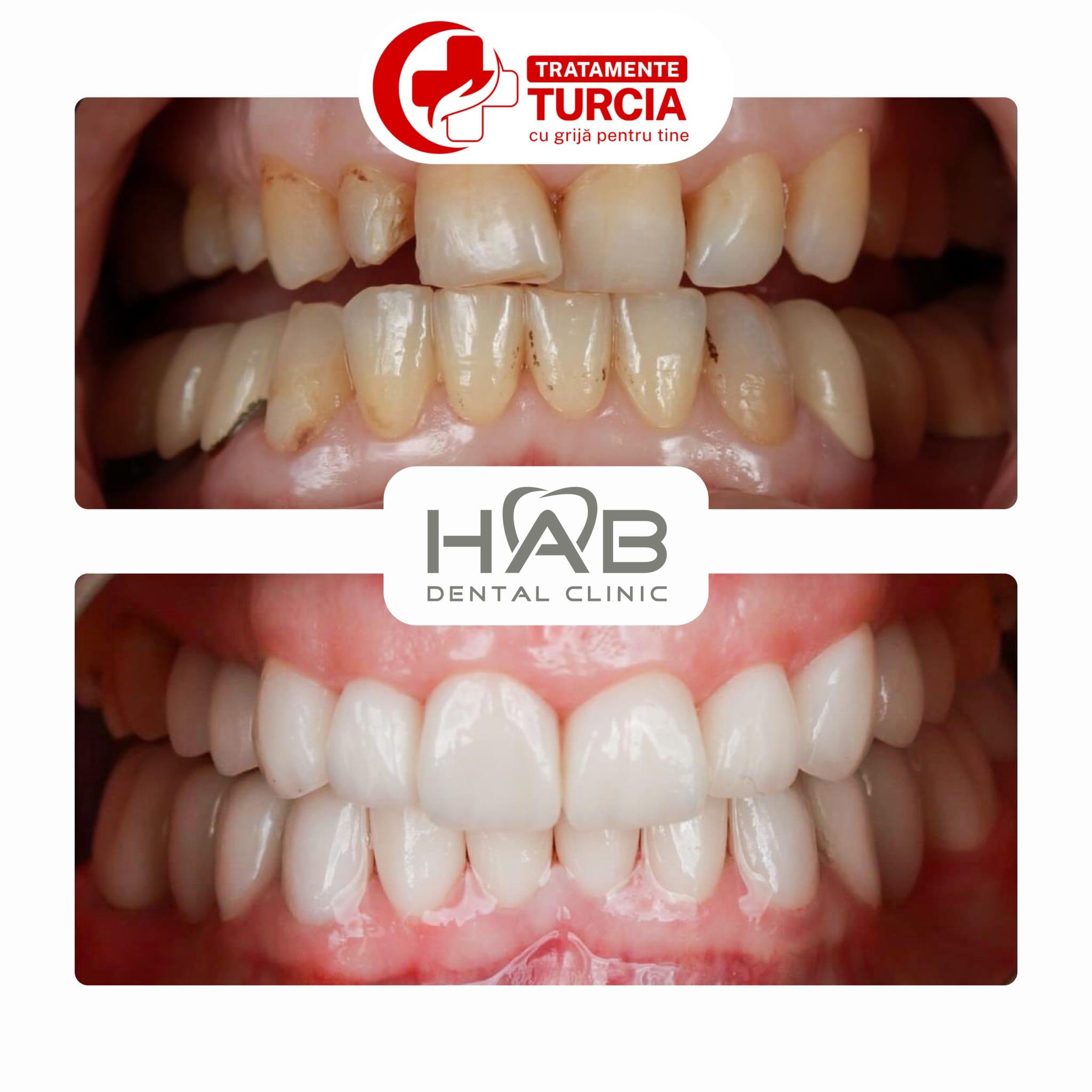 HAB Dental Clinic Vadistanbul — fotografia 22