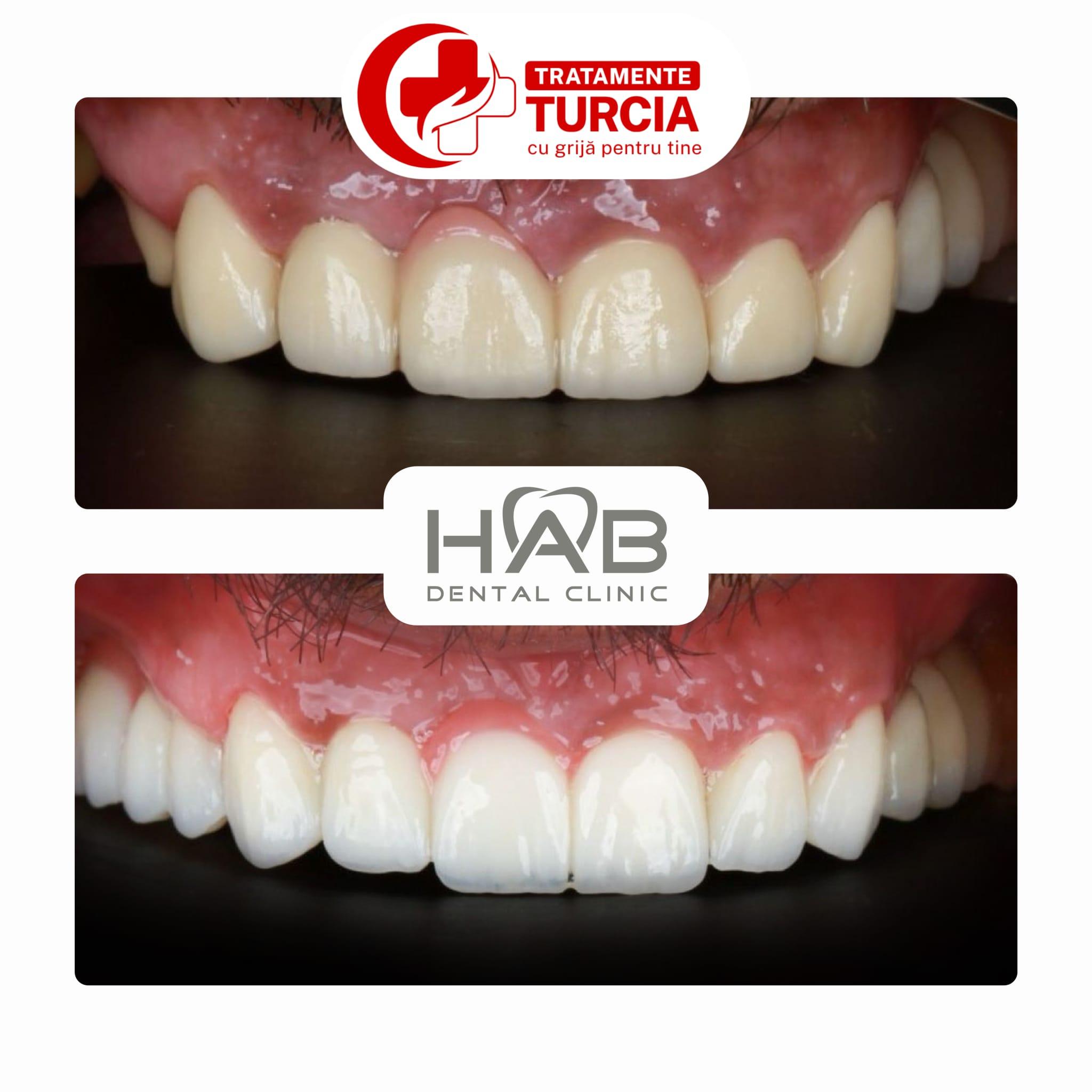 HAB Dental Clinic Vadistanbul — fotografia 31