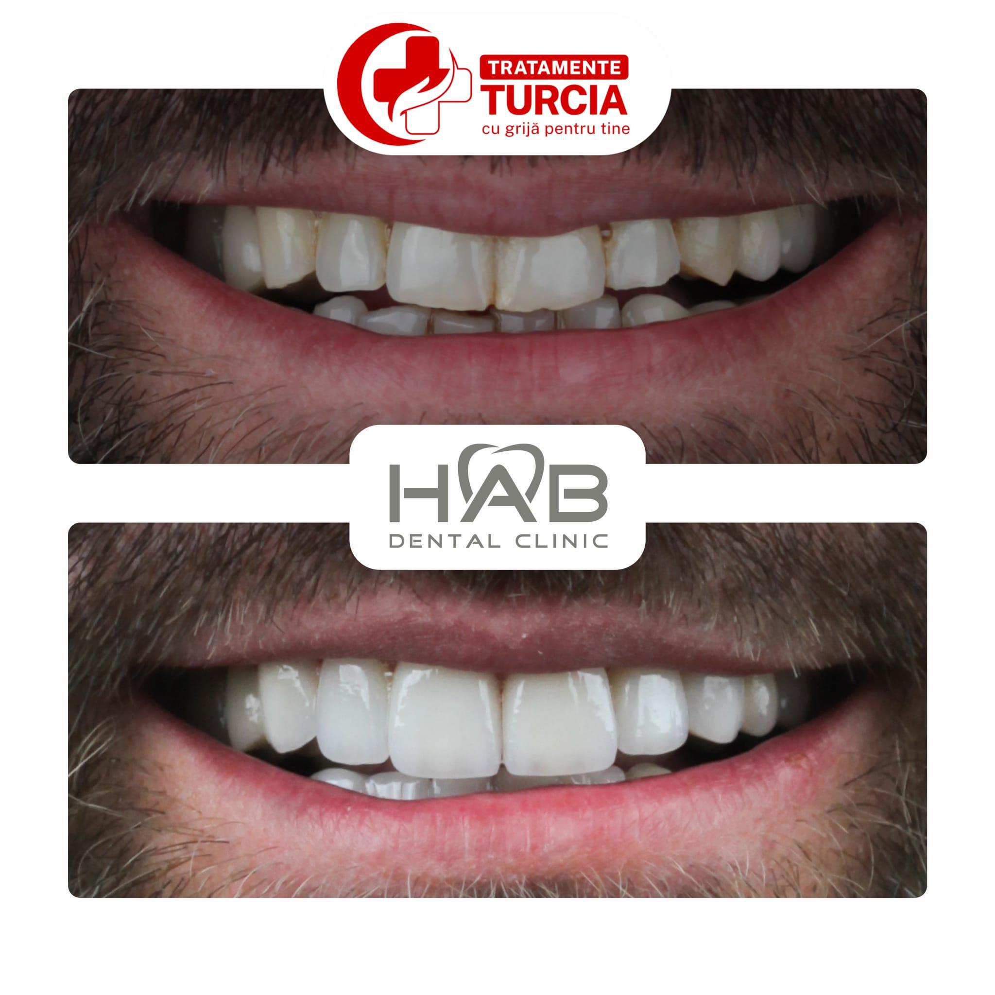 HAB Dental Clinic Vadistanbul — fotografia 33