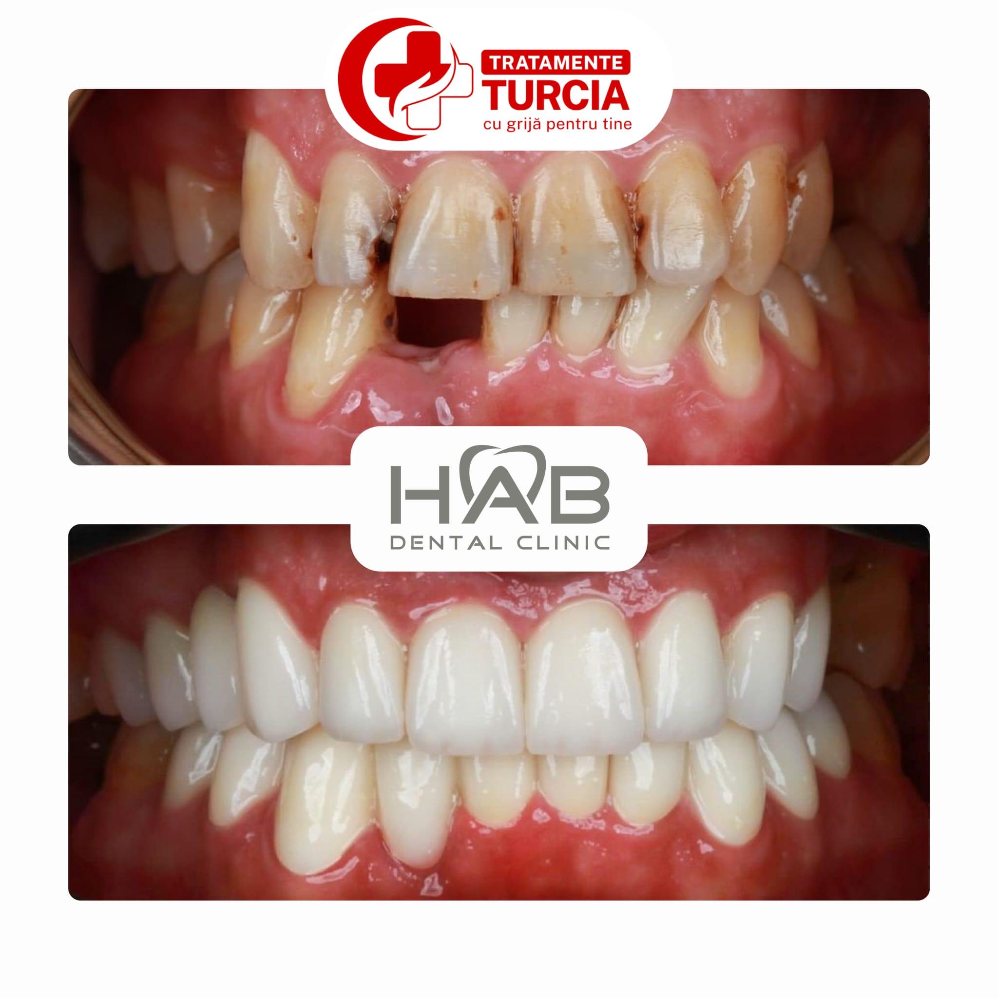 HAB Dental Clinic Vadistanbul — fotografia 32