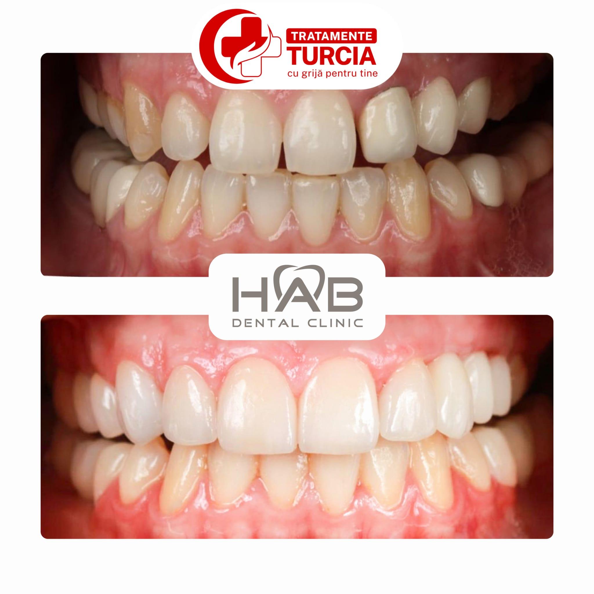 HAB Dental Clinic Vadistanbul — fotografia 35