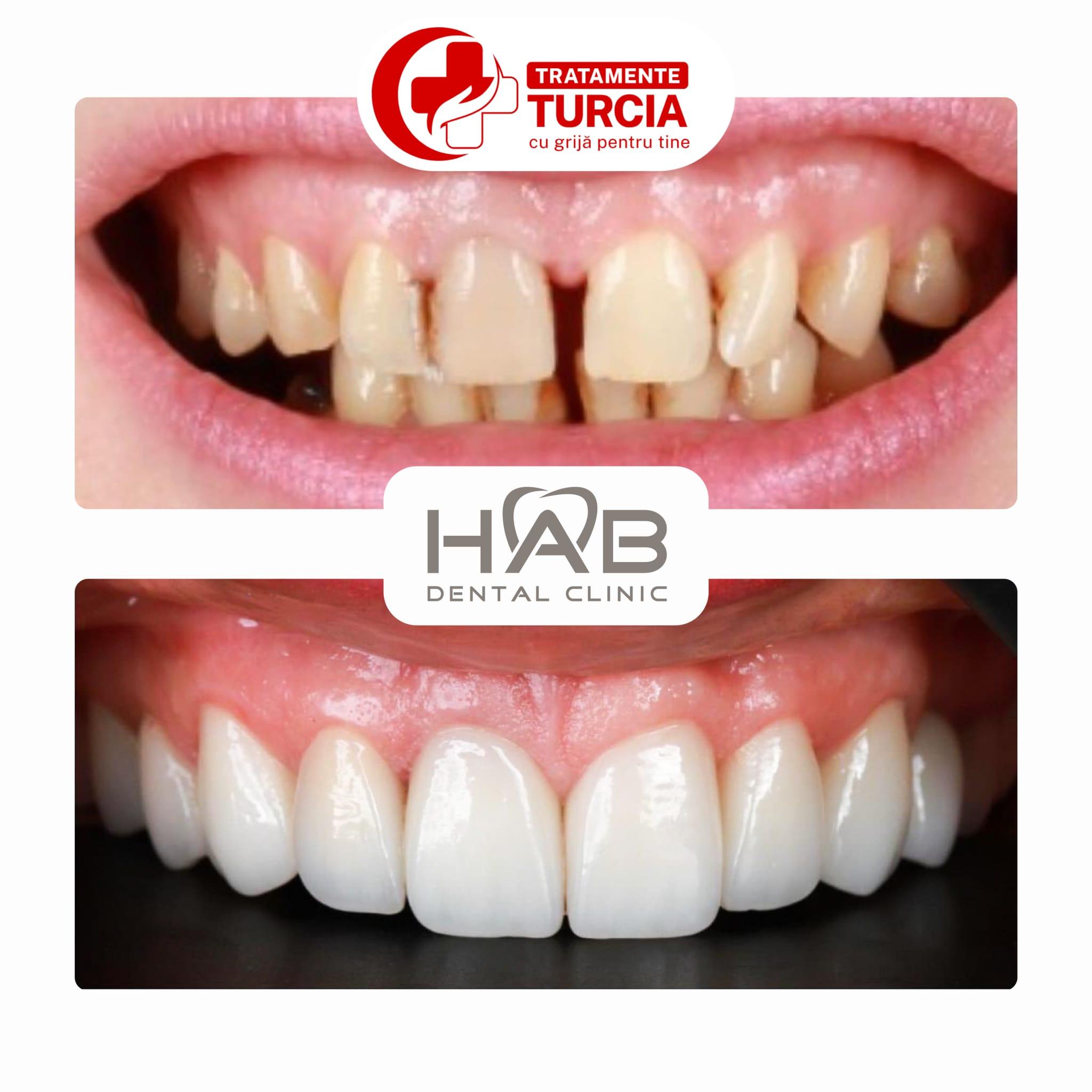 HAB Dental Clinic Vadistanbul — fotografia 34