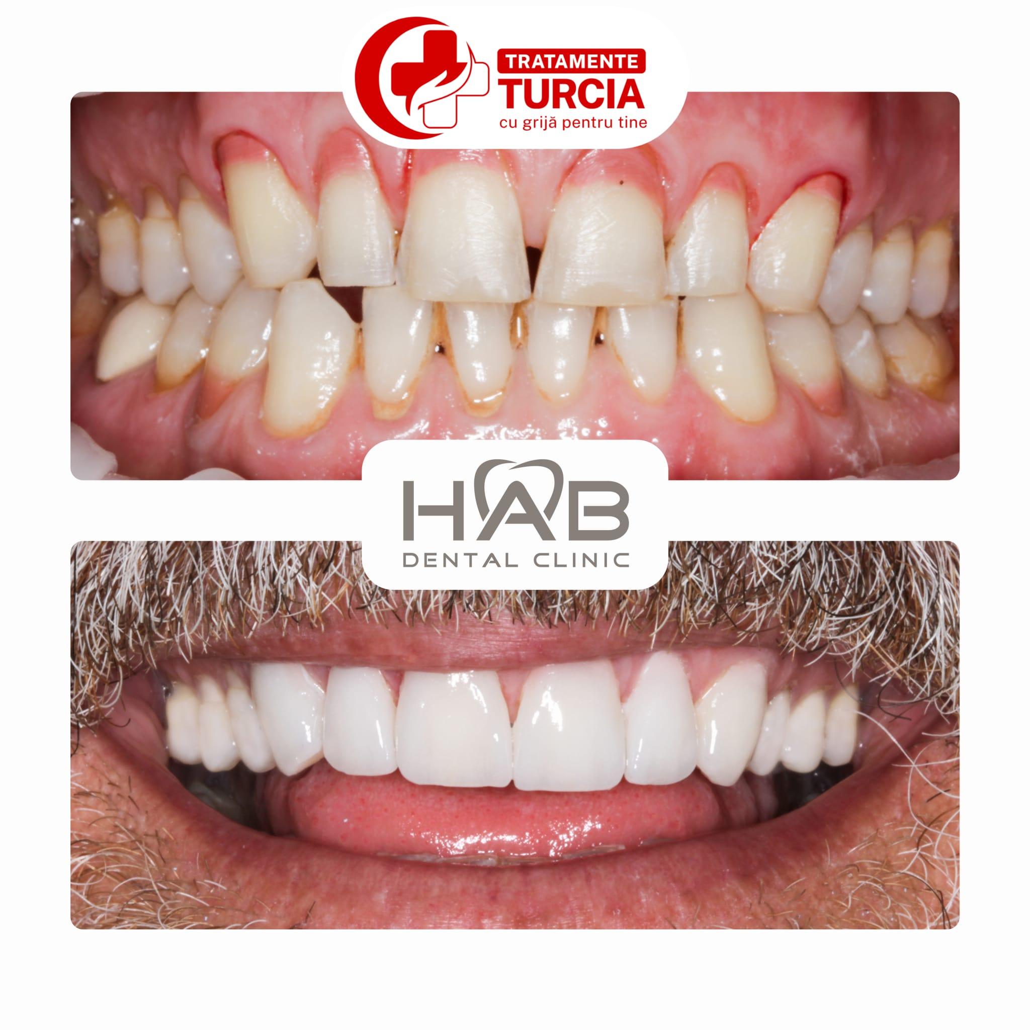 HAB Dental Clinic Vadistanbul — fotografia 36