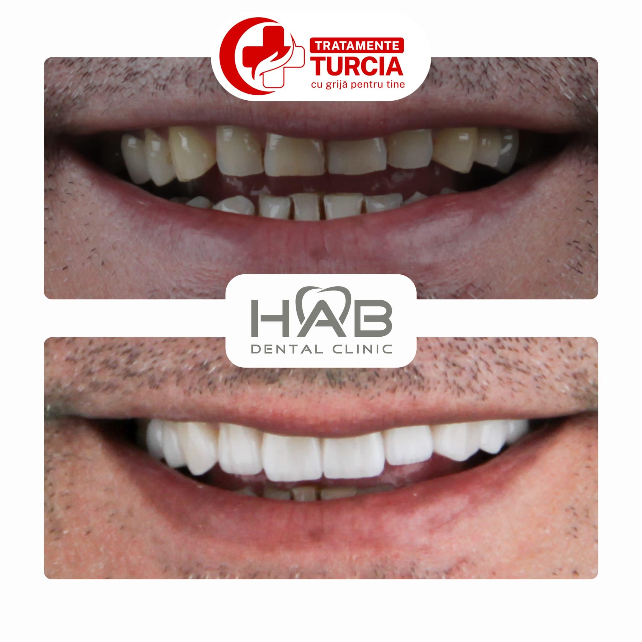 HAB Dental Clinic Vadistanbul — fotografia 38