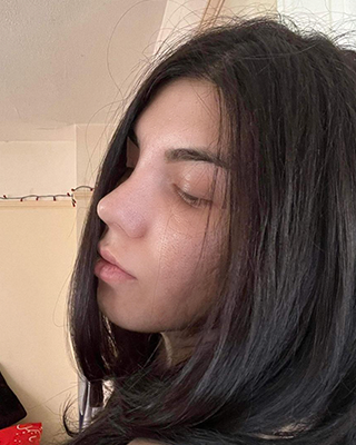 Simina după rinoplastie