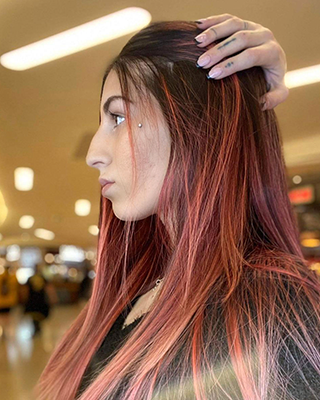 Simina înainte de rinoplastie